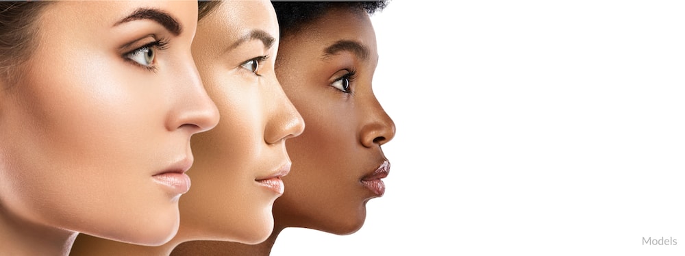 Faces of women with clear, healthy skin.
