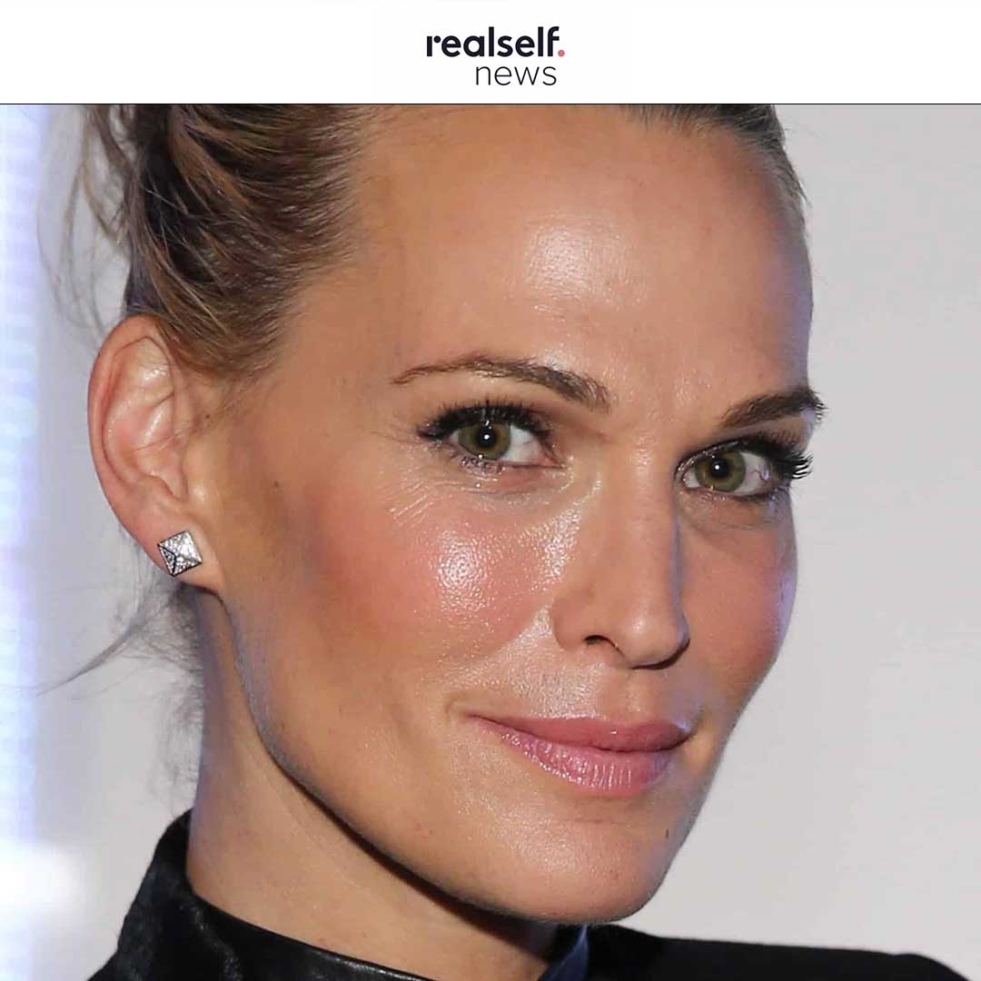 Molly Sims Shares with RealSelf News